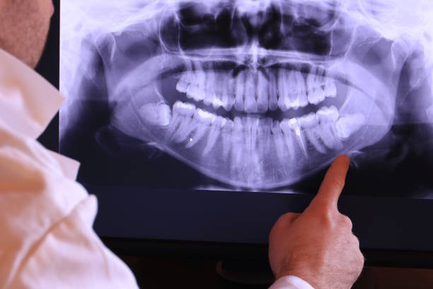 Best Emergency Wisdom Teeth Removal in Schleswig, IA